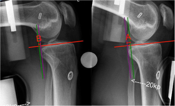 RTG ogólnodiagnostyczne